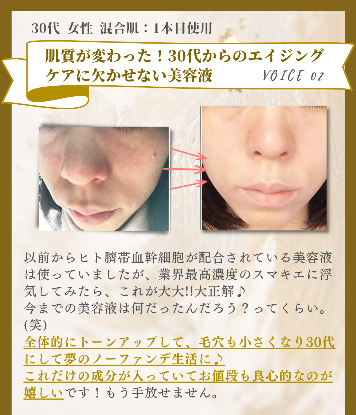 SUMAKIE スマキエセラム【公式】ヒト臍帯血美容液 | [ZELE PLUS