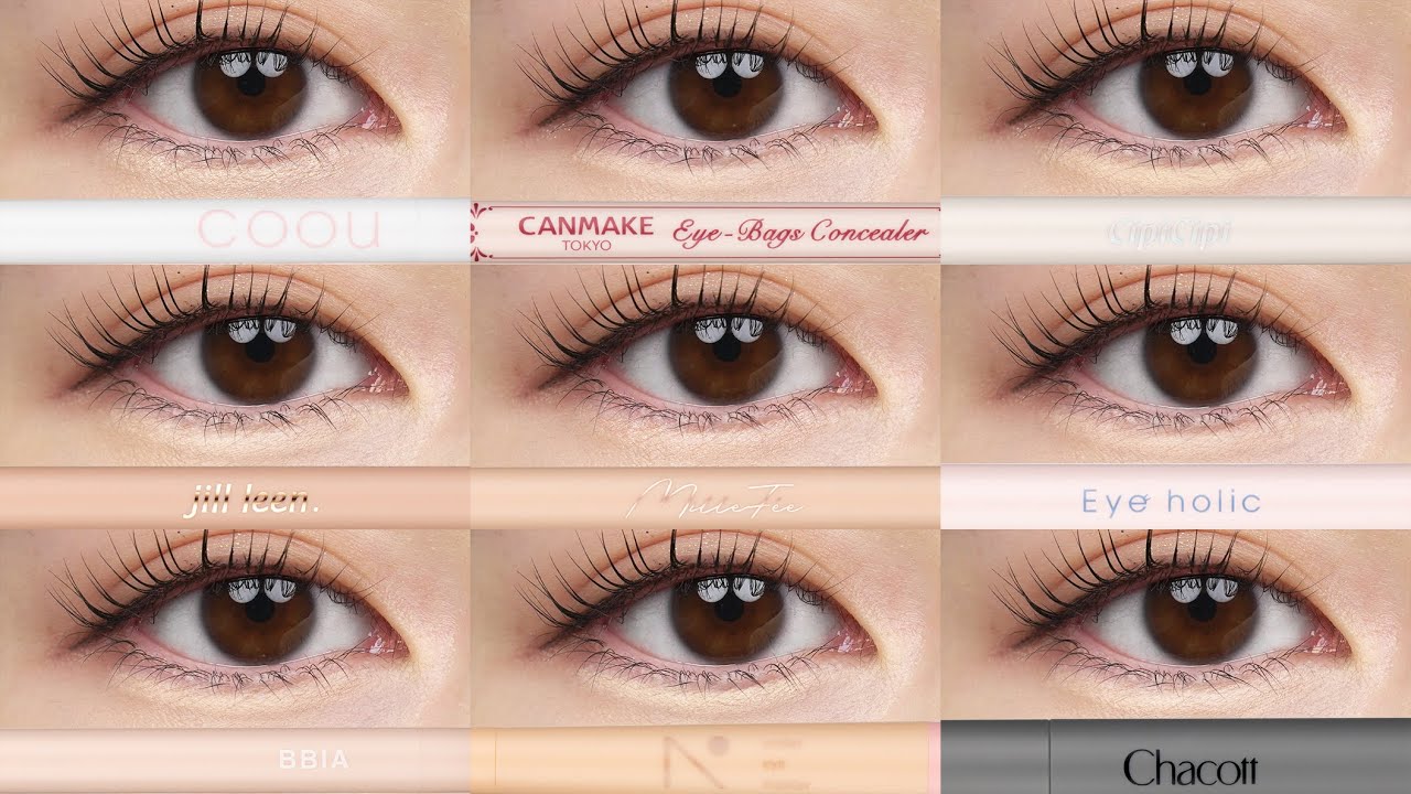 The birth of under-eye bags] A thorough comparison of 9 types of