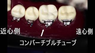 本格実習編【本格コースDVD】 << 各種タイポドント矯正DVD << 矯正教材