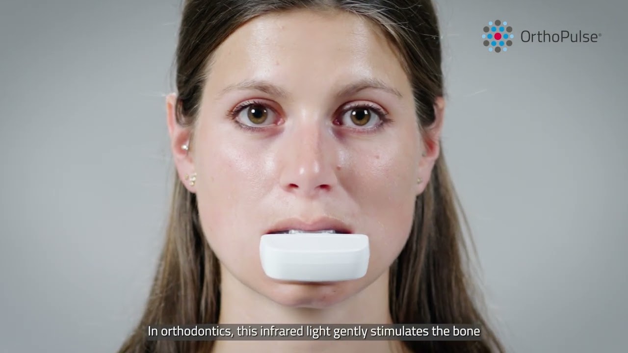 OrthoPulse | Fast Braces & Invisalign in Naperville