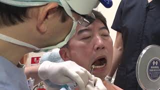 セレック治療 - 摂津富田駅・阪急富田駅近くの歯医者なら高槻ふじい