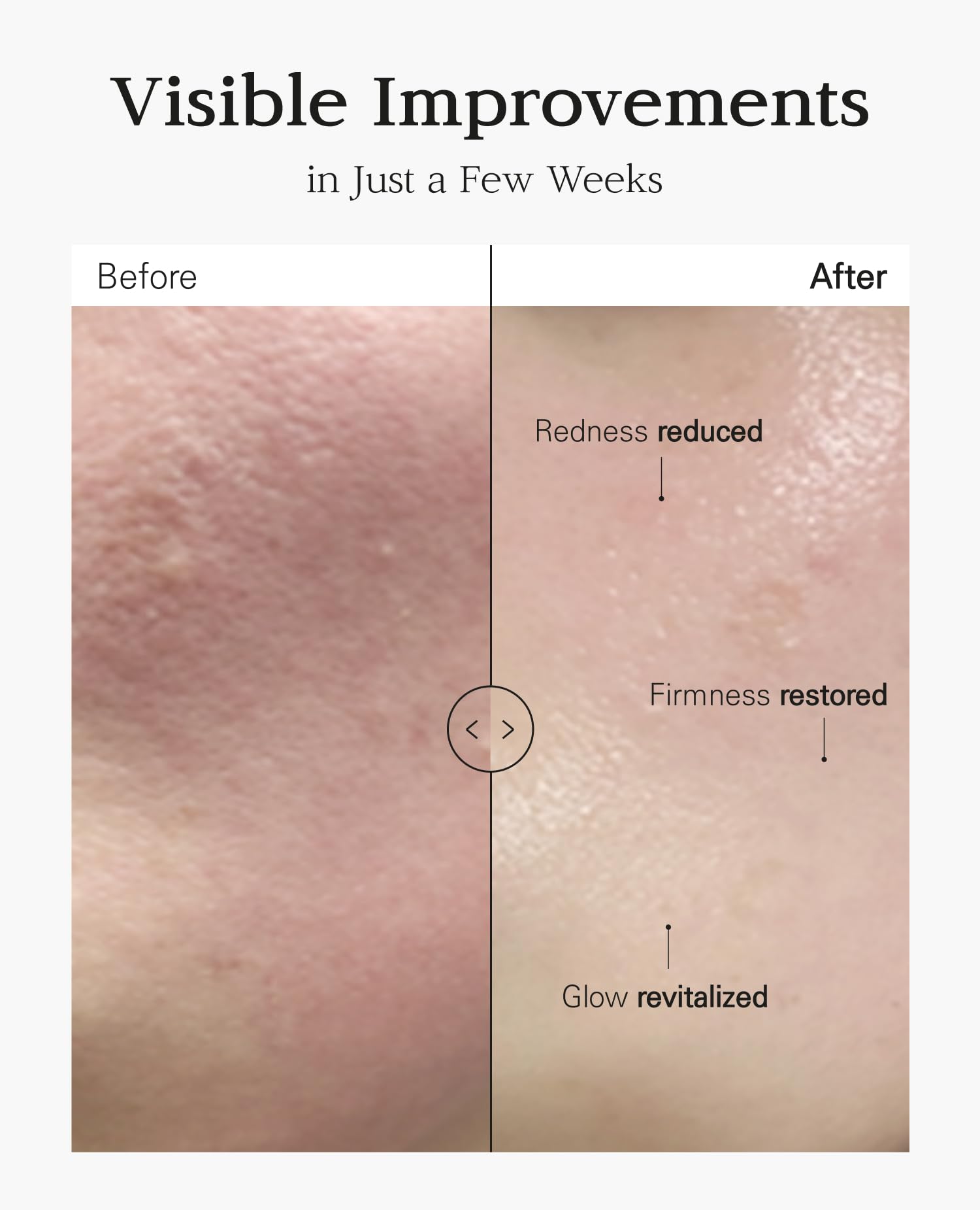 Amazon.com: BLANC DUBU Nuborn Cell Placenta Stem Cell Intensive