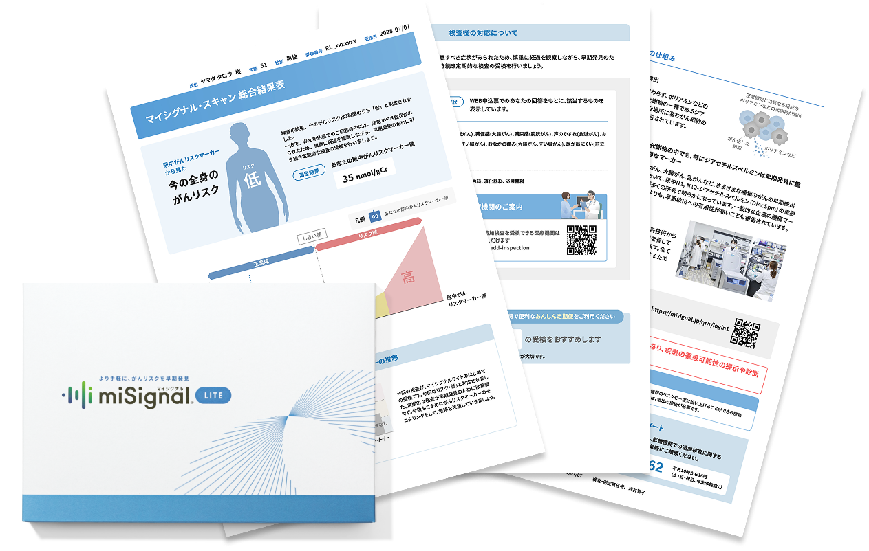 なぜ「尿」でがんリスクが分かるのか？～「マイシグナル・ライト」検査