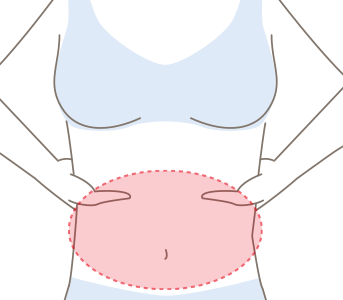 EXPERT MAX BODY | リアムール