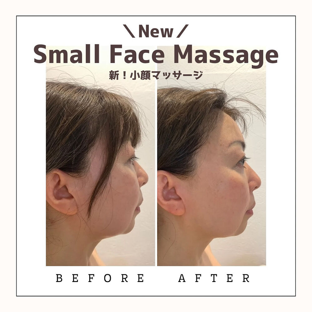 これからレモンボトルという脂肪溶解の美容液を導入した新メニュ