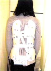 側湾症 【大塚整体治療院】 そくわん症 側わん症 側弯症